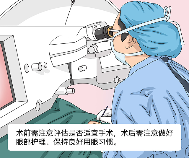 激光近视手术..的前后注意事项及恢复过程