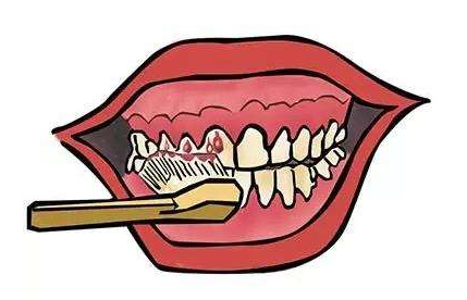 什么情况会导致牙龈出血？出血后应该如何处理？