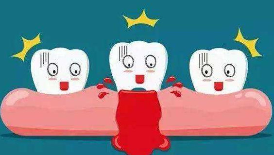牙龈出血是什么原因?如何预防和治疗牙龈出血?