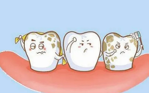 牙菌斑是什么?竟然导致这么多疾病