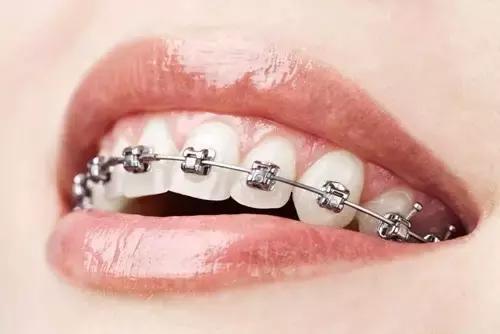 你知道种植牙技术吗？口腔医院告诉你