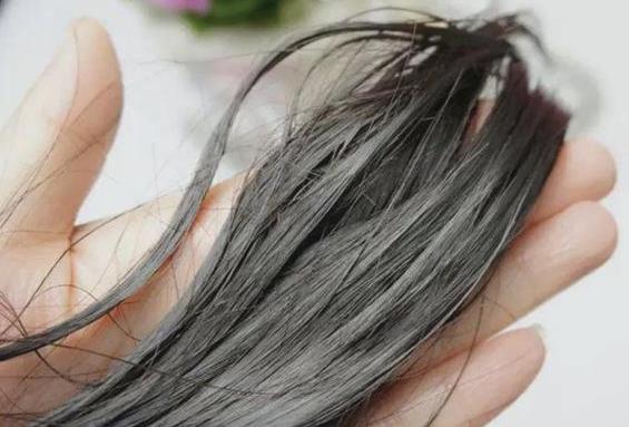 帝茉澜植物养发：导致头皮屑多的原因有那些，你知道吗？