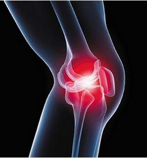 膝关节炎属于哪种病？患病后有哪些反应？