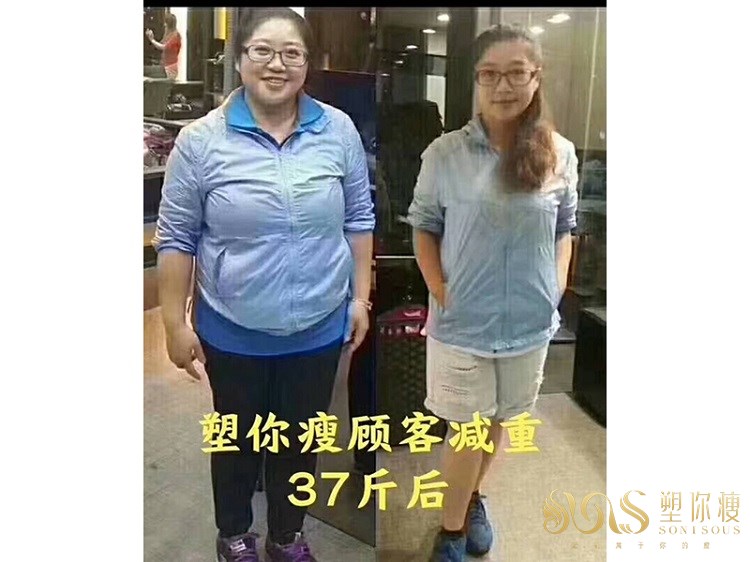 塑你瘦成功案例