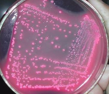 益生菌液应该如何保存？