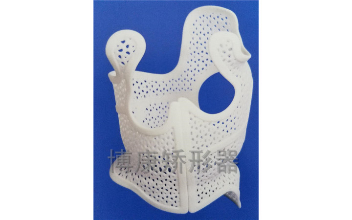 河南矫形器-3D打印脊柱侧弯矫形器