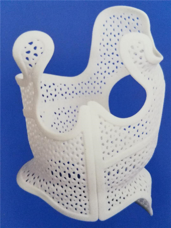 3d打印脊柱侧弯矫形器